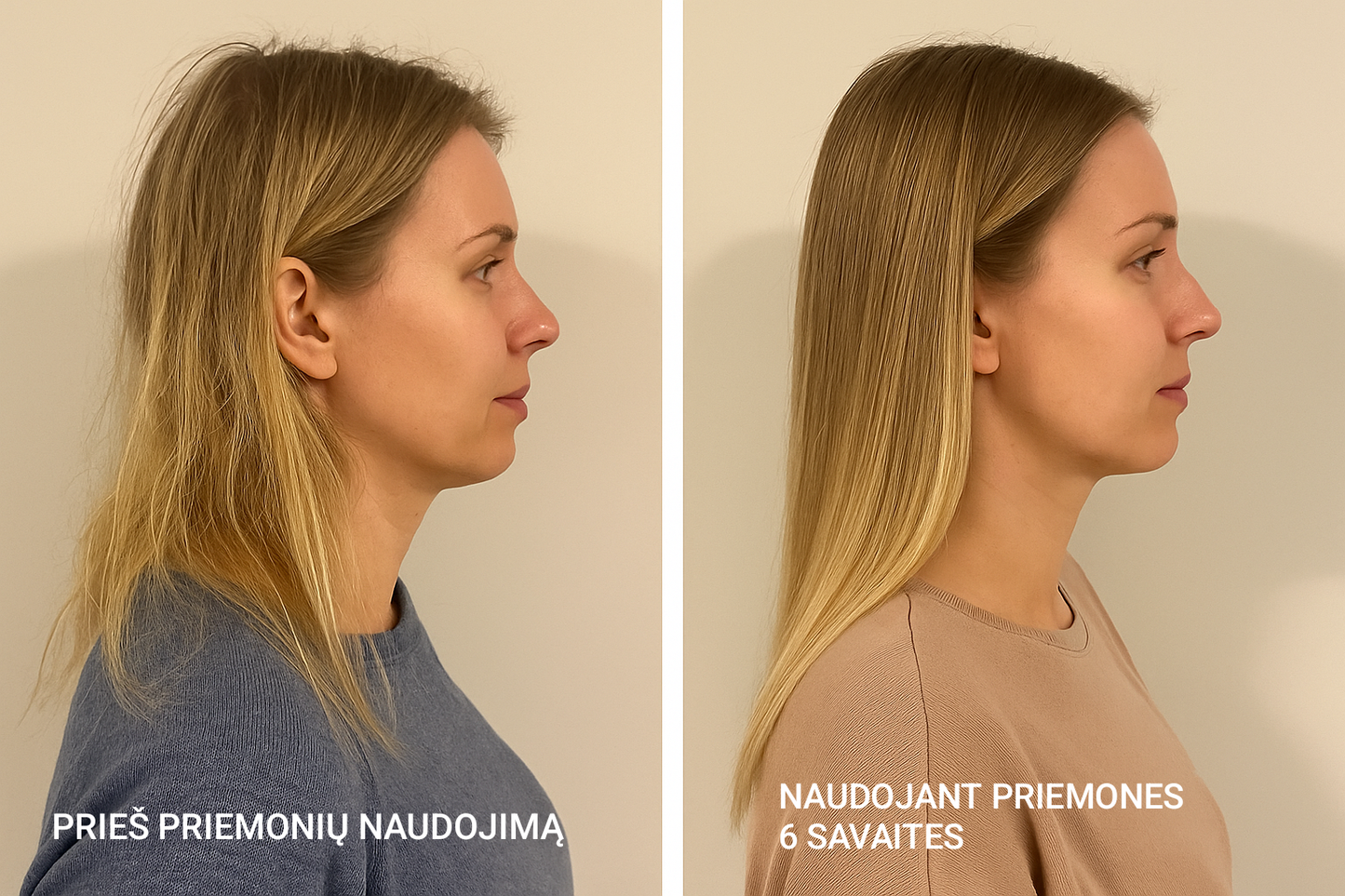 STERLIFE Drėkinamasis šampūnas + ilgo poveikio kondicionuojantis kremas