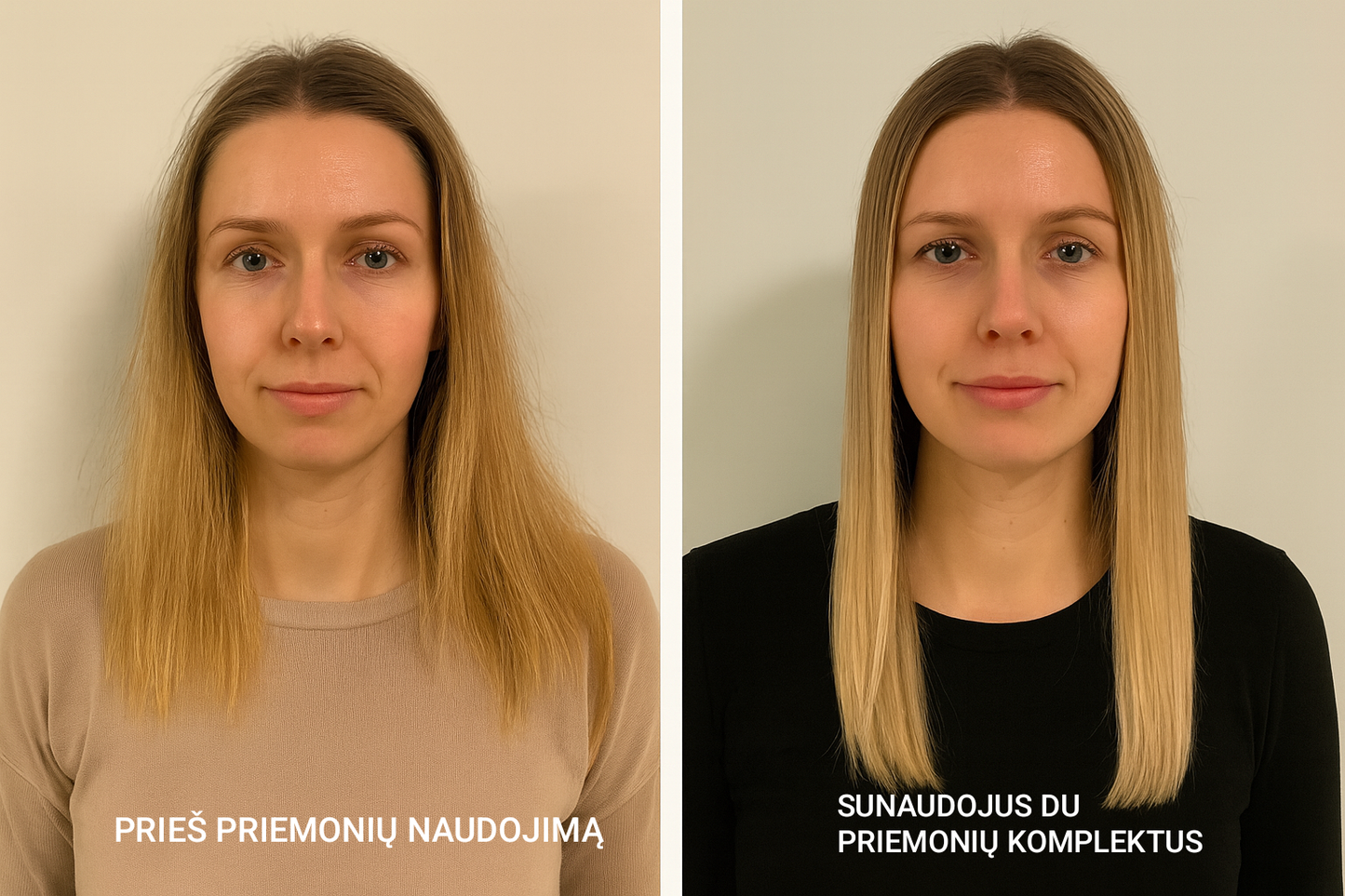 STERLIFE Drėkinamasis šampūnas + ilgo poveikio kondicionuojantis kremas