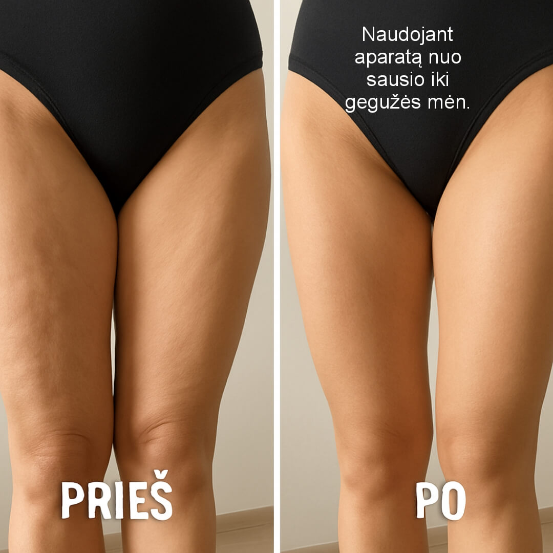 STERLIFE daugiafunkcinis odos priežiūros įrenginys