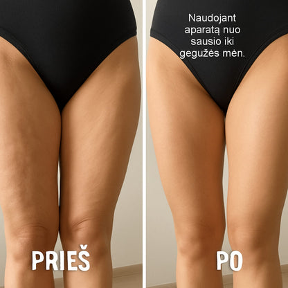 STERLIFE daugiafunkcinis odos priežiūros įrenginys